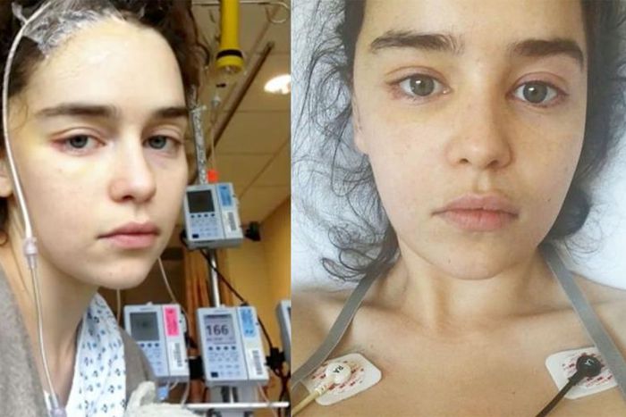 Emilia Clarke Shares New Pics After Brain Surgery