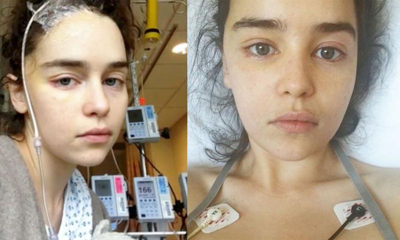 Emilia Clarke Shares New Pics After Brain Surgery