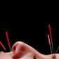 Can Acupuncture Really Help You Lose Weight?