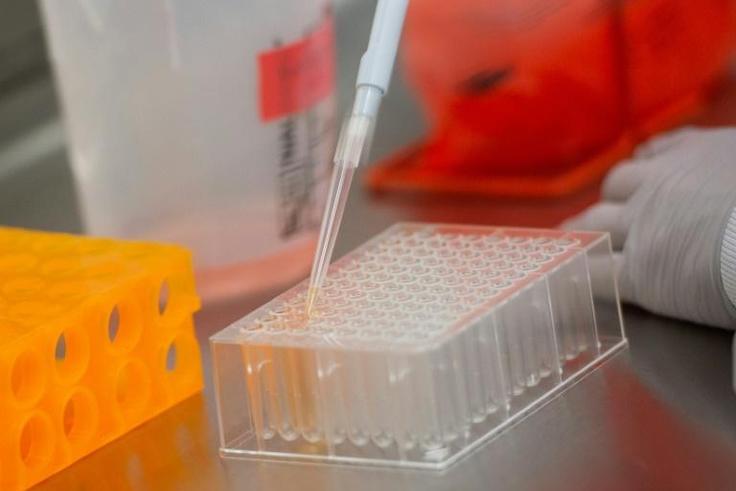 Mmore than 100 vaccine research projects are under way around the world, according to an analysis published Monday