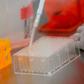 Mmore than 100 vaccine research projects are under way around the world, according to an analysis published Monday