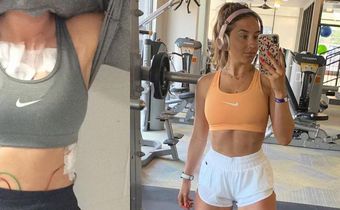 'Exercising With Mono Almost Killed Me'