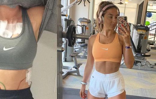 'Exercising With Mono Almost Killed Me'