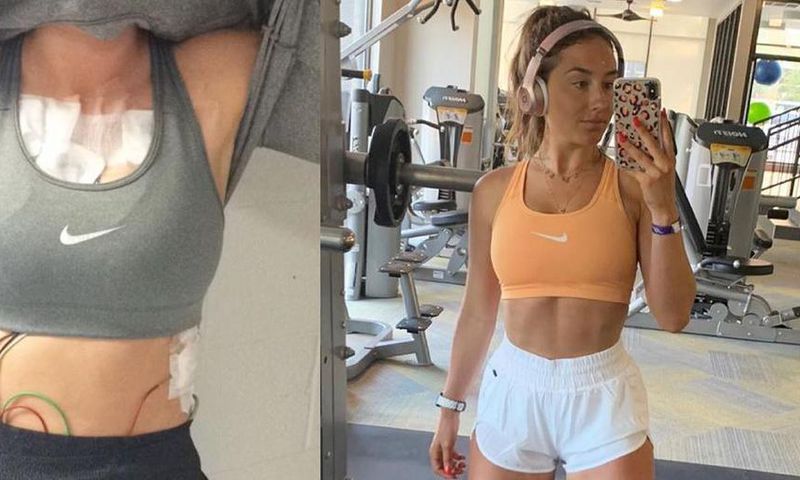 'Exercising With Mono Almost Killed Me'