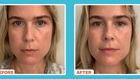 'This Fancy New Eye Cream Erased My Eye Bags'