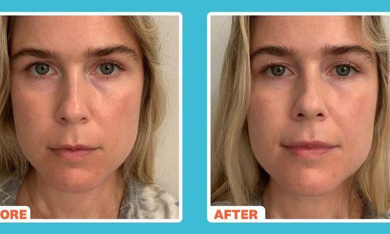 'This Fancy New Eye Cream Erased My Eye Bags'