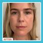 'This Fancy New Eye Cream Erased My Eye Bags'