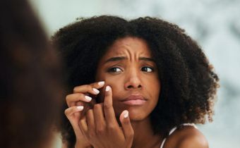 Reasons why your acne never seem to disappear