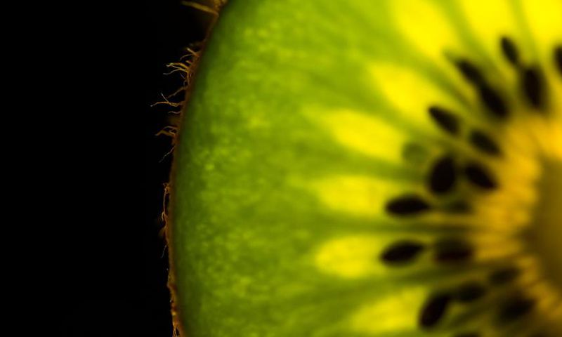 Dr. Pimple Popper Plucks 'Kiwi Hairs' Out of Pores
