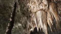 Watch Dr. P Squeeze A 'Stalagmite' Ear Whitehead