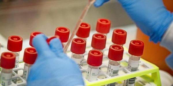 Coronavirus samples
