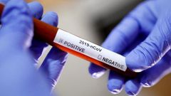 Health CS Mutahi Kagwe confirms 9 new cases of Coronavirus, total rises to 25 with 4 counties affected - Nairobi, Mombasa, Kwale, Kilifi