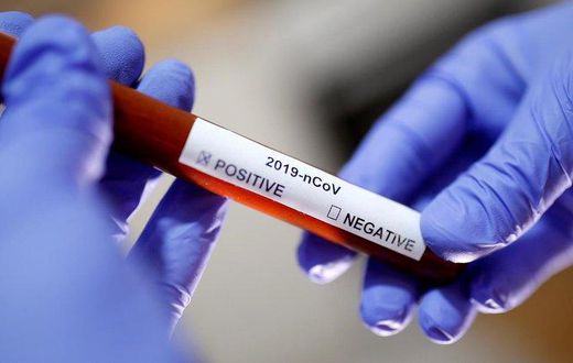Health CS Mutahi Kagwe confirms 9 new cases of Coronavirus, total rises to 25 with 4 counties affected - Nairobi, Mombasa, Kwale, Kilifi