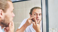 13 Home Remedies for Acne That Actually Work