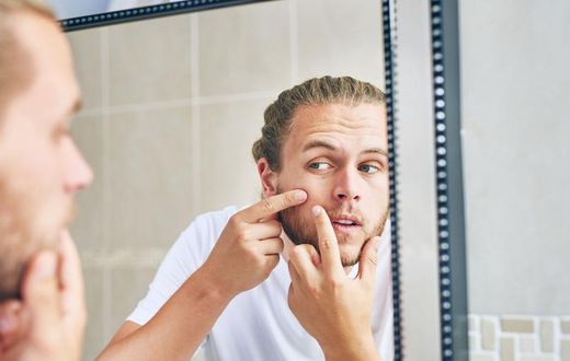 13 Home Remedies for Acne That Actually Work