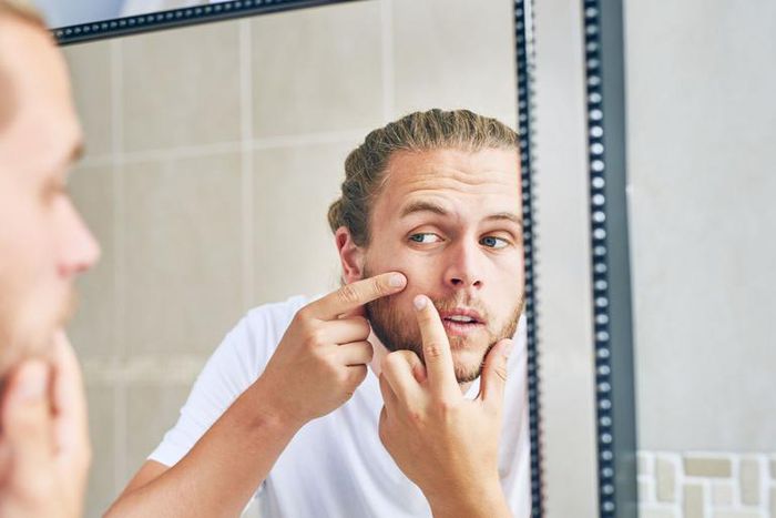 13 Home Remedies for Acne That Actually Work