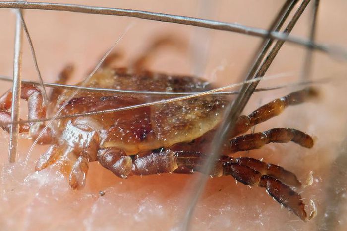 The Right Way to Get Rid of Ticks