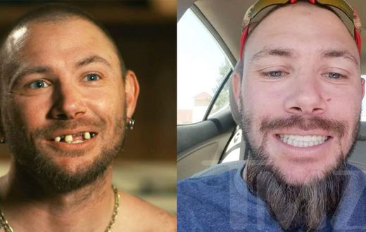 'Tiger King' Star John Finlay Got New Teeth