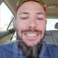'Tiger King' Star John Finlay Got New Teeth