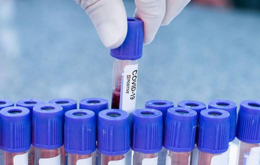 What to Know About COVID-19 Pool Testing