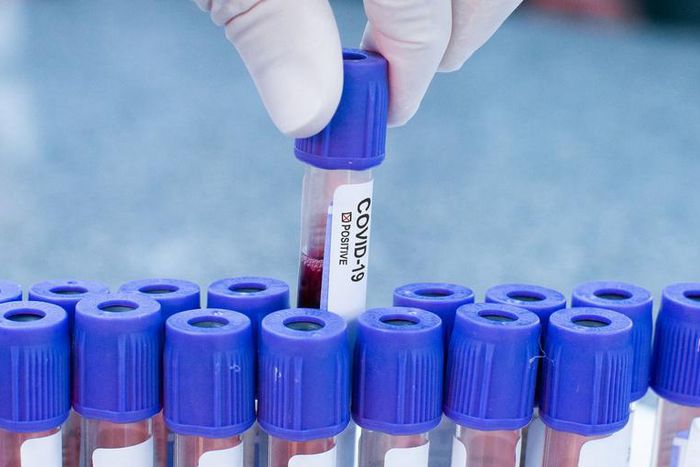 What to Know About COVID-19 Pool Testing