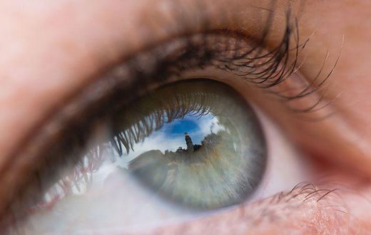 Dr. Pimple Popper Pops a Blackhead Next to an Eye
