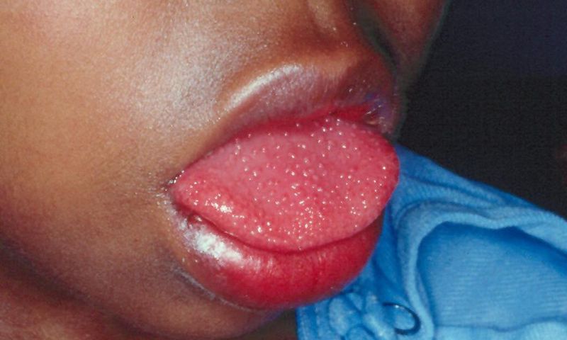 Children affected by strange disease linked to Covid-19
