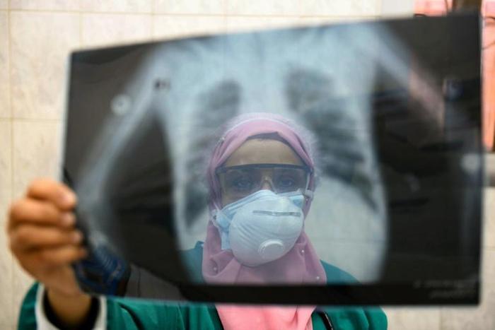 With a population of 100 million, Egypt is the Arab world's most populous country and doctors have been battling to prevent the coronavirus from taking hold