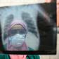 With a population of 100 million, Egypt is the Arab world's most populous country and doctors have been battling to prevent the coronavirus from taking hold