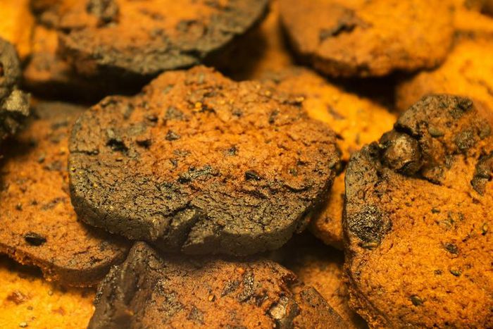 Dr. Pimple Popper Removes Solar Comedos