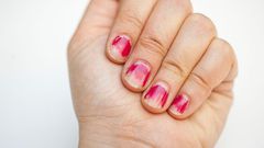 ___7013054___https:______static.pulse.com.gh___webservice___escenic___binary___7013054___2017___7___18___23___chipped-manicure