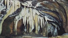 Dr. Pimple Popper Popped a Stalagmite Cyst