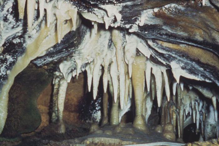 Dr. Pimple Popper Popped a Stalagmite Cyst