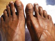 Moisturize feet after scrubbing to prevent hard skin (Vibe)