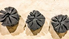 Watch Dr. P Extract 'Breathtaking' Blackheads