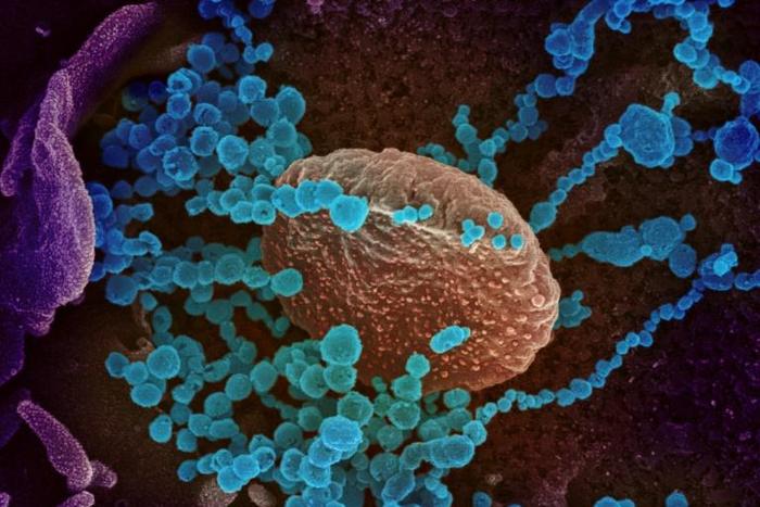 Authors of the study, say it is the first time experts have mapped the body's general immune response to the new disease