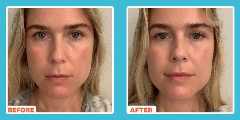 Immediately after using the eye cream with the rollerball applicator.