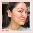 What Is a Microcurrent Facial?