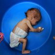 A Yemeni child suffering from malnutrition is weighed at a treatment centre in northern Hajjah province