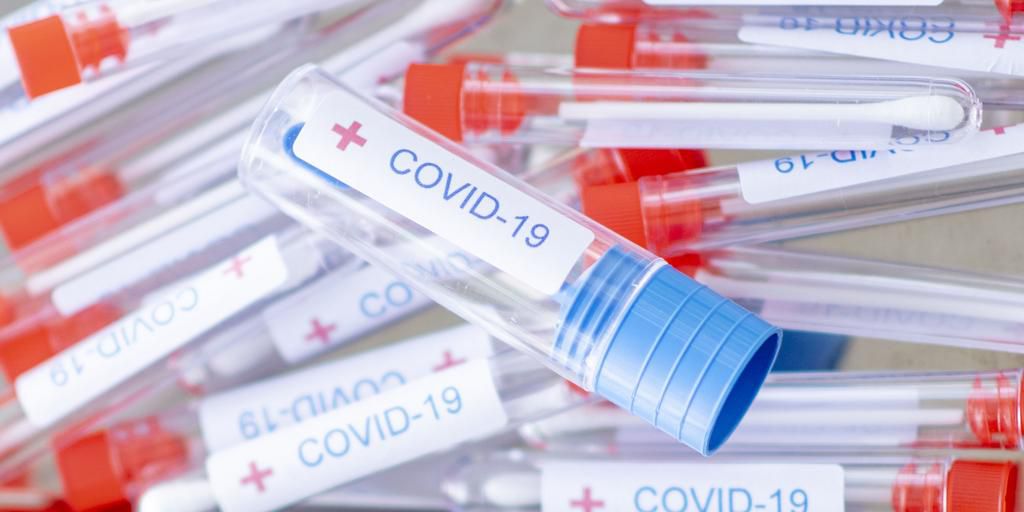 Are At-Home Novel Coronavirus Test Kits Accurate?