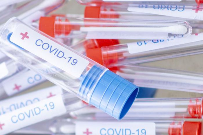Are At-Home Novel Coronavirus Test Kits Accurate?