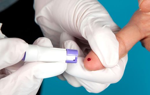 Should You Get a COVID-19 Antibody Test?