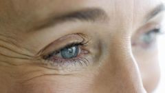 Dr. Pimple Popper Squeezes DPOW On Woman's Eye