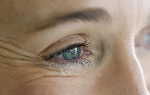Dr. Pimple Popper Squeezes DPOW On Woman's Eye