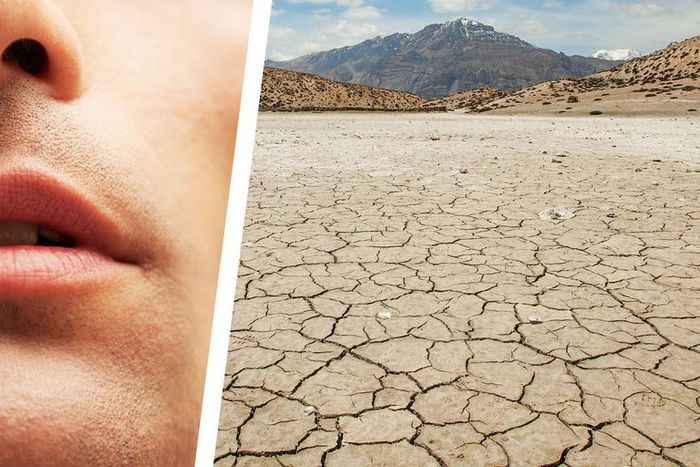 Why You Have a Dry Mouth—and How to Fix It