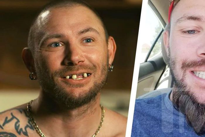 'Tiger King' Star John Finlay Has New Teeth