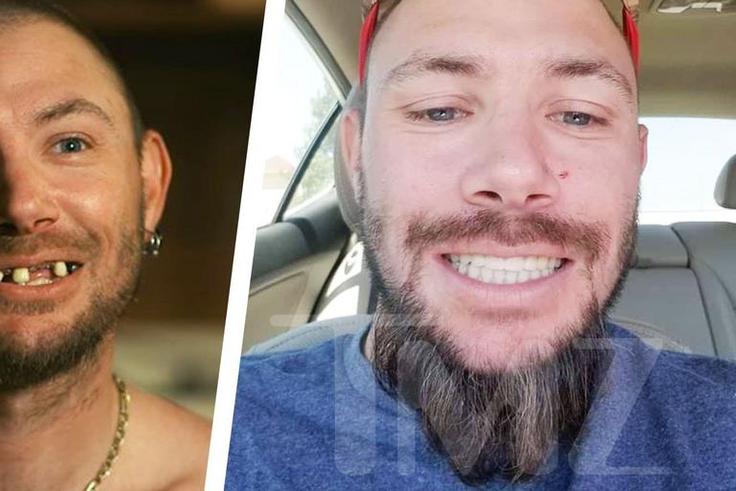'Tiger King' Star John Finlay Has New Teeth