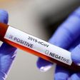 Laboratory technician holds up a Covid-19 positive sample in a vial (Reuters)