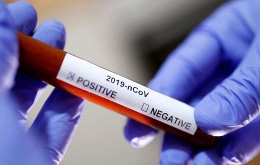 Laboratory technician holds up a Covid-19 positive sample in a vial (Reuters)
