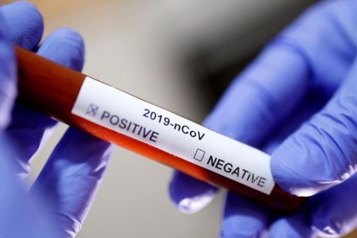 Laboratory technician holds up a Covid-19 positive sample in a vial (Reuters)